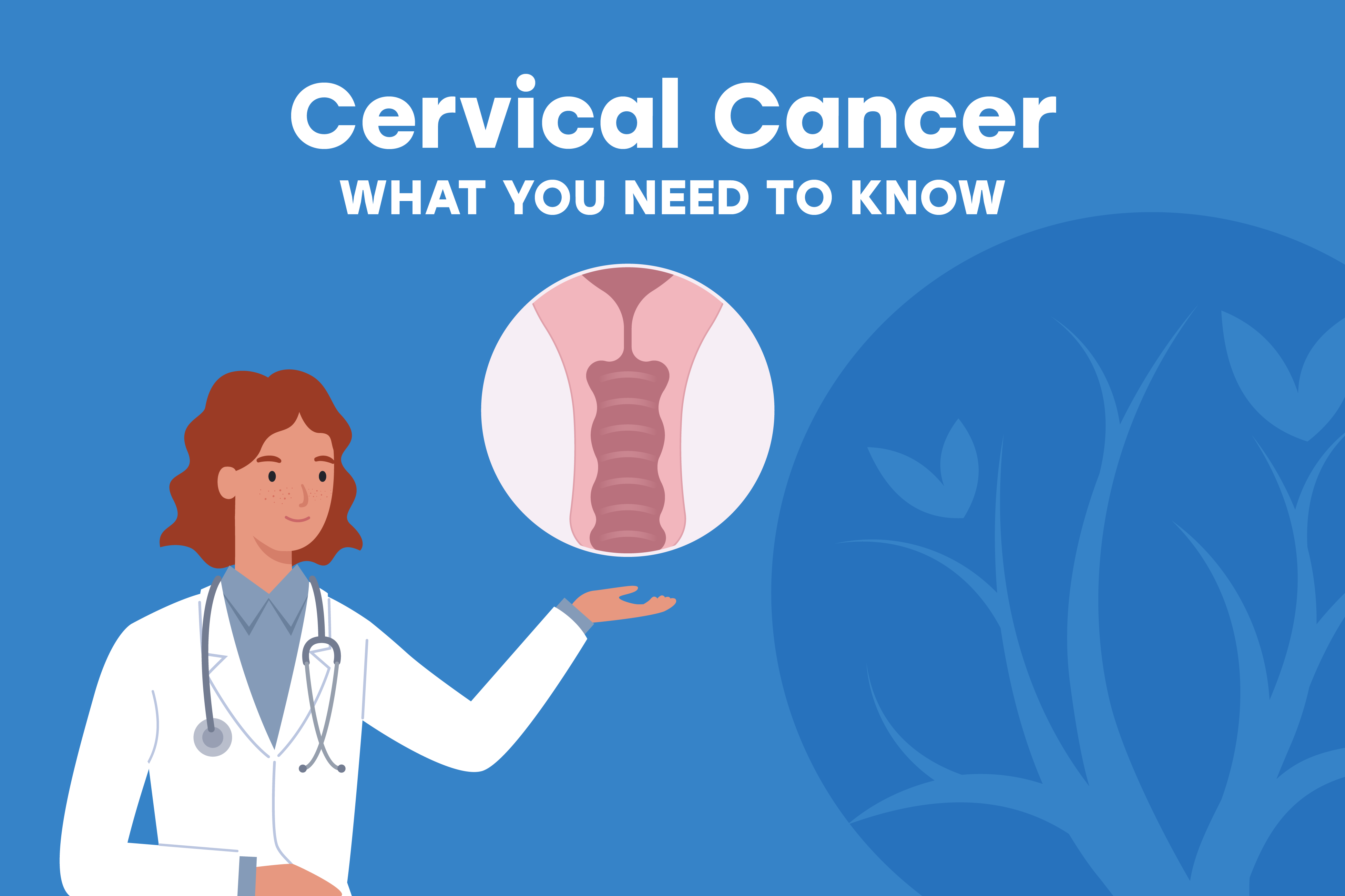 What you need to know about cervical cancer